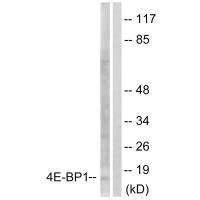 EIF4EBP1 (Ab-64) antibody