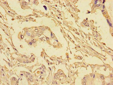 EIF4EBP1 Antibody
