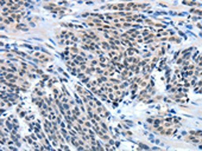 EIF4EBP1 antibody