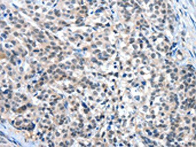 EIF4EBP1 antibody