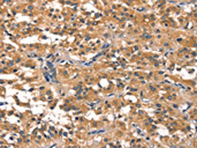 EIF4G1 Antibody