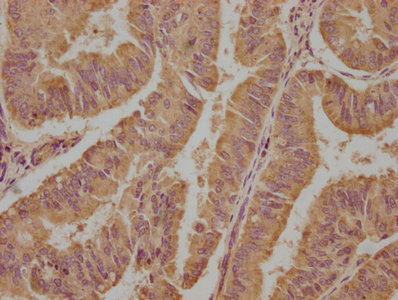 EIF4G2 antibody