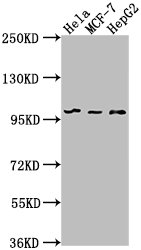 EIF4G2 antibody