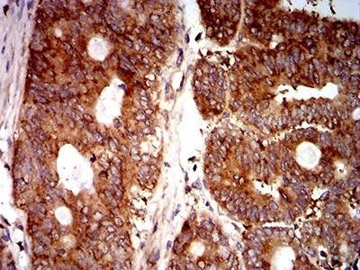 EIF5 Antibody