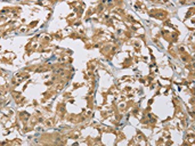 EIF5 Antibody