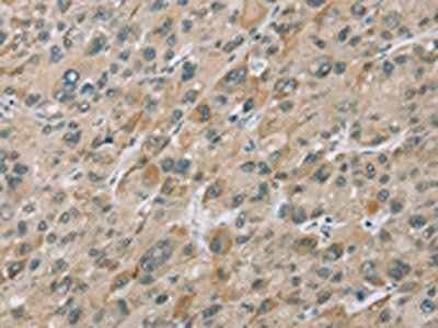 EIF5 Antibody