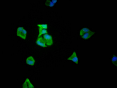 EIF5A Recombinant Monoclonal Antibody