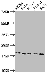 EIF5A Recombinant Monoclonal Antibody