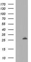 EIF5A2 Antibody