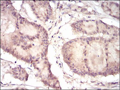 EIF5A Antibody