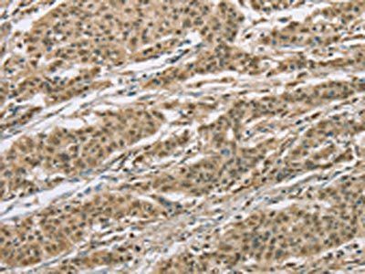 ELAC2 antibody