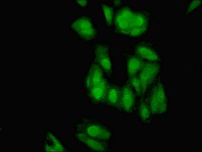 ELAV-like protein 2 antibody