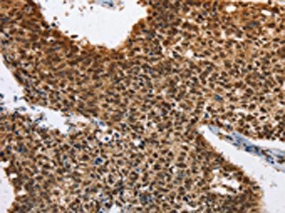 ELAVL1 Antibody