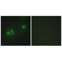 ELAVL2/ELAVL4 Antibody