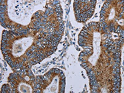 ELAVL3 antibody