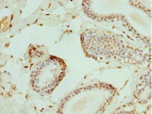 ELF1 Antibody
