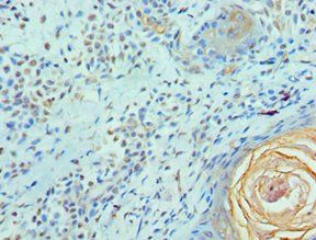 ELF4 Antibody