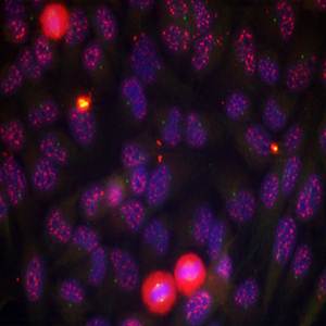 Elk1(Phospho-Thr417) Antibody