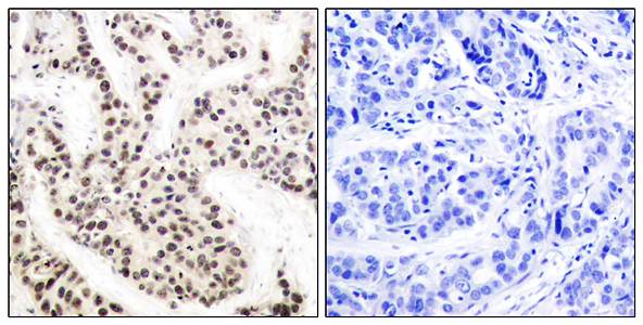 Elk1(Phospho-Thr417) Antibody