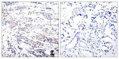 ELK1 Antibody