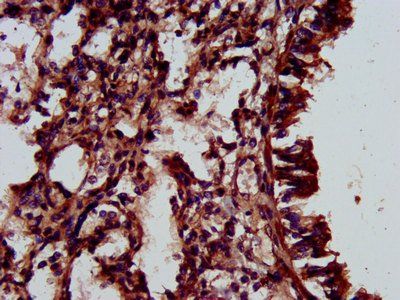 ELMOD3 Antibody