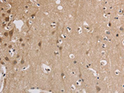 ELOVL1 Antibody