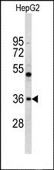ELOVL2 antibody