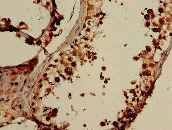 ELOVL4 Antibody