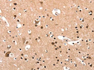 ELOVL6 Antibody