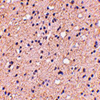 ELOVL6 Antibody