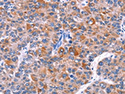 ELP2 antibody