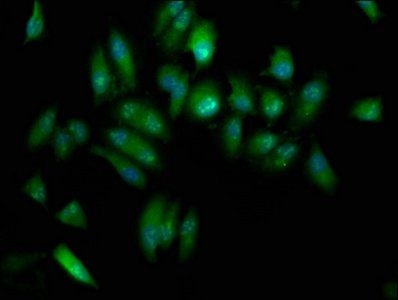 ELP3 antibody