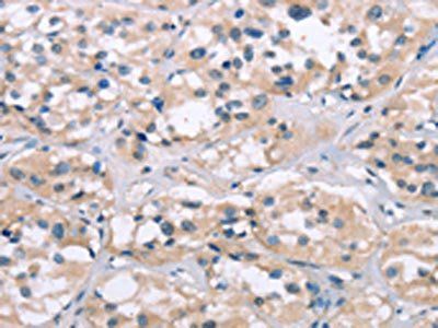 ELP3 Antibody