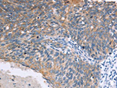 ELP3 Antibody