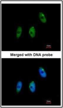 elongator acetyltransferase complex subunit 3 Antibody