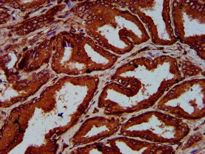 ELP4 Antibody