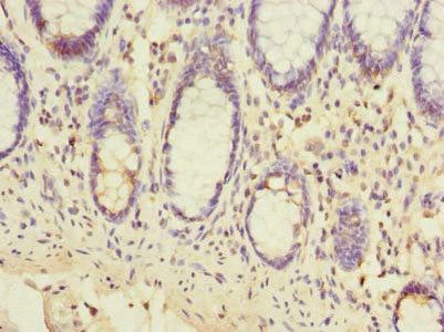 EMC6 Antibody