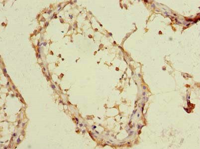 EMC6 Antibody
