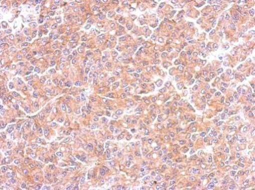 EML1 antibody [C3], C-term