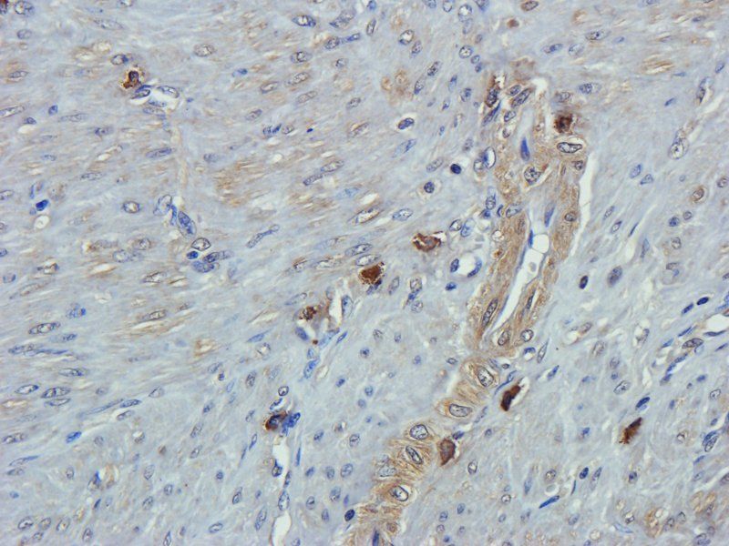 Emp1 antibody