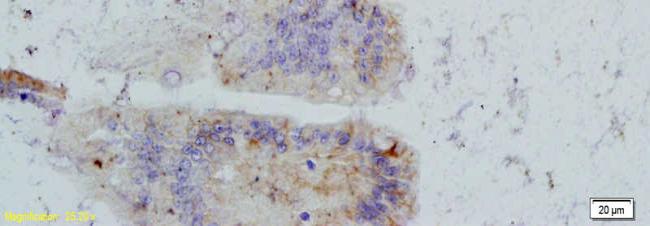 EMP3 Rabbit Polyclonal Antibody