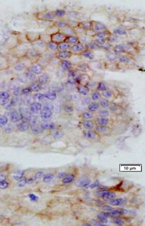 EMP3 Rabbit Polyclonal Antibody