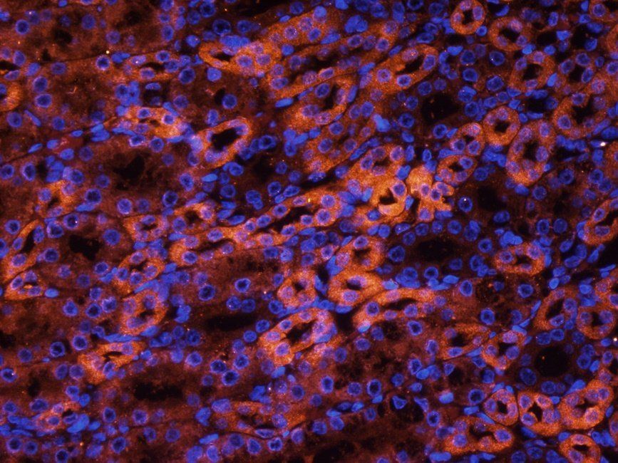 ENaC Alpha antibody