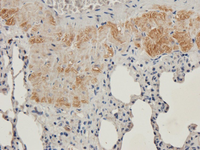 ENaC Alpha antibody