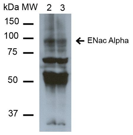 ENaC alpha Antibody