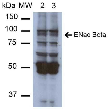 ENaC beta Antibody