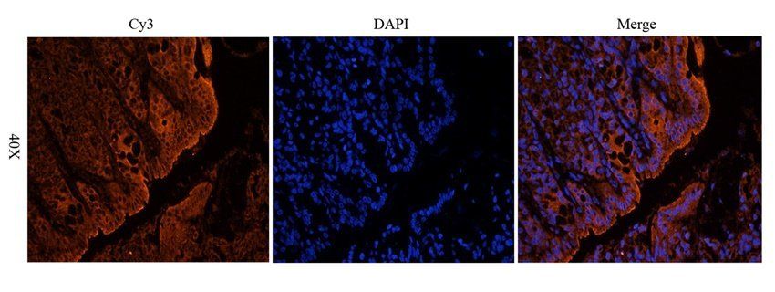 ENaC gamma antibody