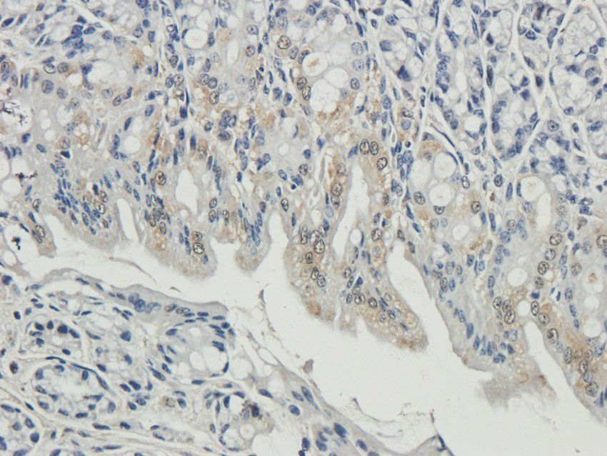 ENaC gamma antibody