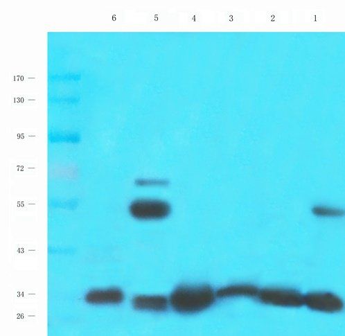 ENaC gamma antibody