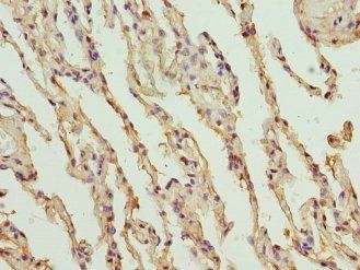 Endothelial protein C R antibody